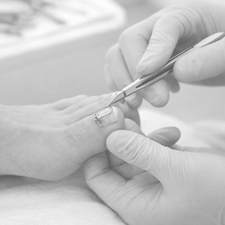 Füße werden bei einer Pediküre mit einer Zange gepflegt.