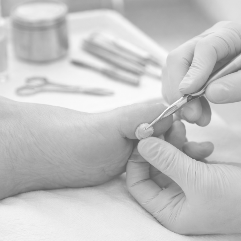 Manuelle Fußpflege, ein Fuß wird gereinigt und bearbeitet.